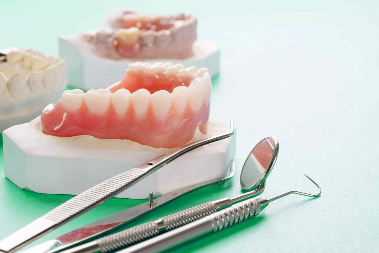 جایگزین‌های ایمپلنت دندان