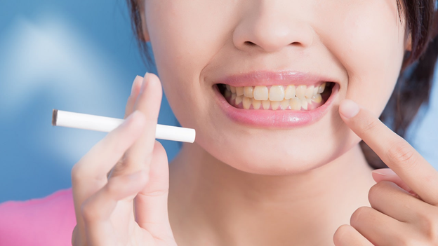 تاثیر دخانیات بر ایمپلنت دندان